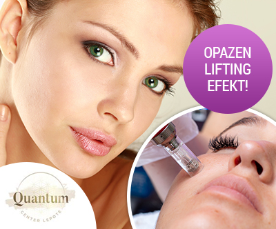 Quantum center lepote: microneedling obraza