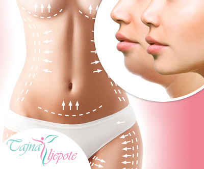 Salon Tajna ljepote: cryocoolsculpting