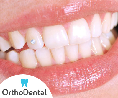 Do lepega nasmega z dentalnim nakitom Swarovski!