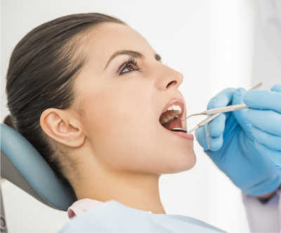 Doktor Dentalne medicine: čiščenje zobnega kamna