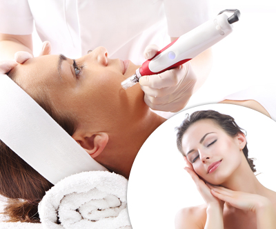 Društvo Vitus: pomlajevalni tretma microneedling