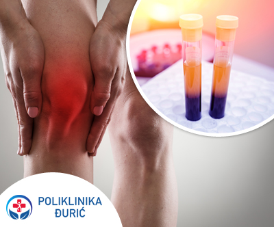 Poliklinika Đurić, tretma ACP za zdravljenje