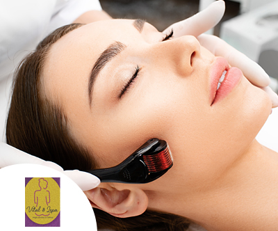 Salon Vital&Lepa, microneedling obraza za mladostno kož