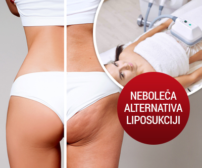 Studio Nice, Zagreb: CryocoolSculpting 