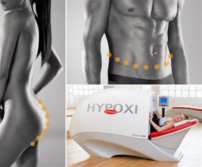 HYPOXI-Trening