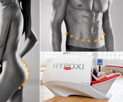 Hypoxi studio