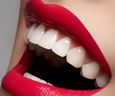 Profesionalno lasersko 3D beljenje zob
