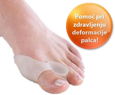 opornica za hallux valgus