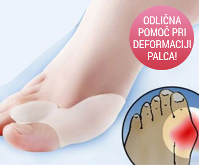 opornica za hallux valgus