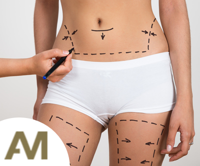 lipolaser