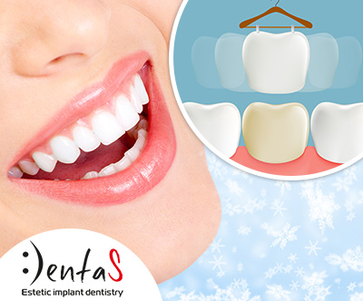 Dental studio Dentas