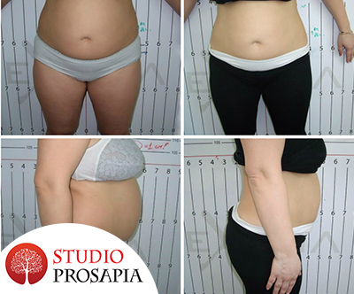 Studio Prosapia