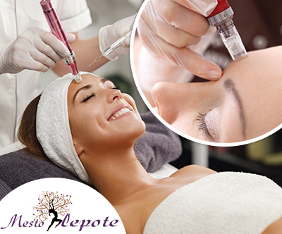 Salon Mesto lepote: Microneedling obraza