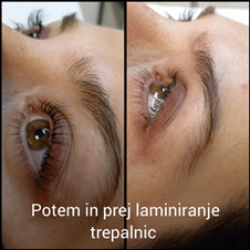 Lepotni studio Shine: laminiranje trepalnic