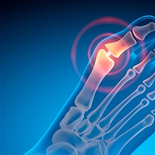 Komplet opornic za nego ukrivljenih prstov nog!