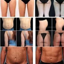 Lepotni studio Mi dí: oblikovanje telesa