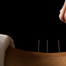 Tradicionalna kitajska medicina, TKM, akupunktura