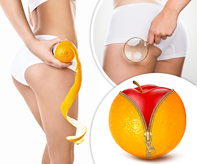 Ayurveda &Spa center: shujševalno-anticelulitni program Ayurveda &Spa center: shujševalno-anticelulitni program