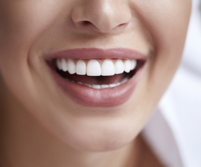 Marn medica: čiščenje zobnega kamna, poliranje Marn medica: čiščenje zobnega kamna, poliranje