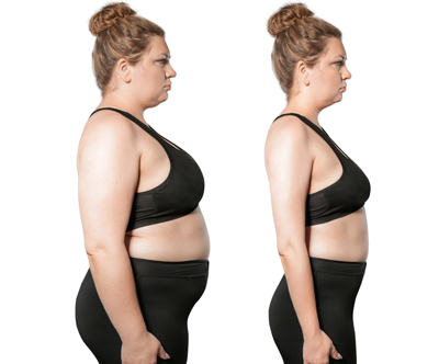 Studio Nice, Zagreb: CryocoolSculpting Studio Nice, Zagreb: CryocoolSculpting