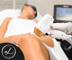 Nailash beauty studio, Lasersko odstranjevanje dlačic