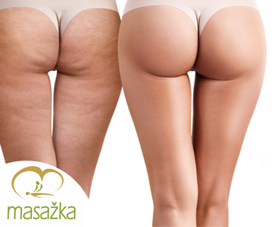 Salon Masažka endospheres terapija Salon Masažka endospheres terapija