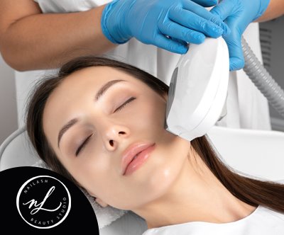 Nailash beauty studio, lasersko odstranjevanje dlačic