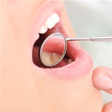 Doktor Dentalne medicine: čiščenje zobnega kamna