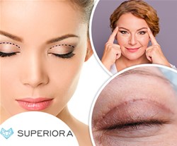 Poliklinika Superiora