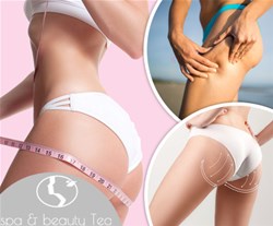 Preoblikovanje telesa