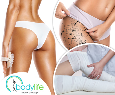 Odlicen anticelulitni tretma v centru Bodylife na Ptuju
