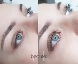 Keratinsko vihanje trepalnic