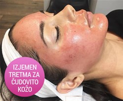 Nega obraza