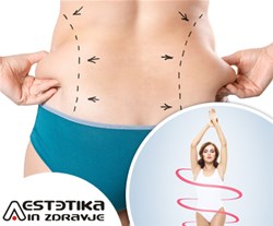 aestetika