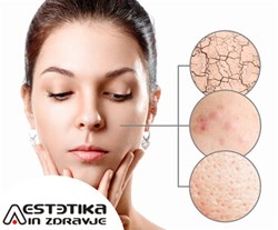 aestetika