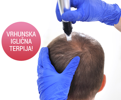 Kozmetični salon Oaza lepote: microneedlig (lasišče)