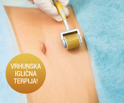 Kozmetični salon Oaza lepote: microneedlig (trebuh)