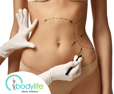 Center Bodylife: vakuum terapija, limfna drenaža (5x)